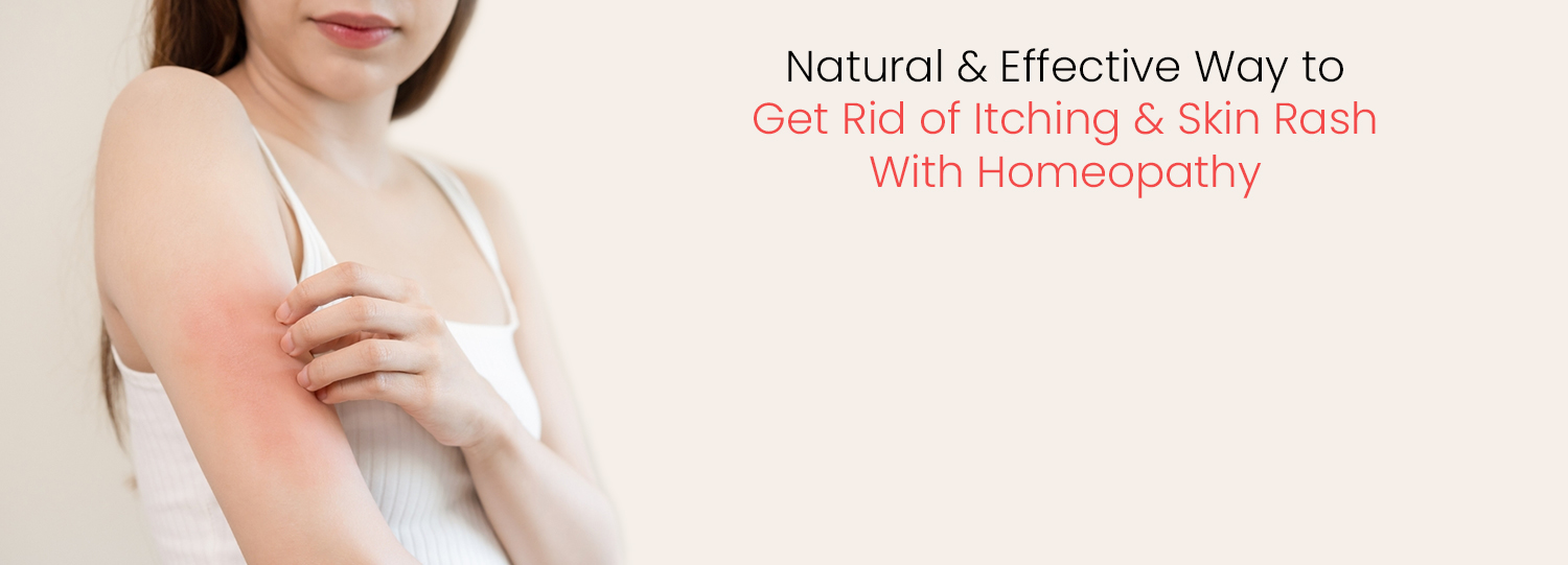Homeopathy for Itching & Rash
