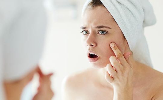 7-common-culprits-that-cause-acne