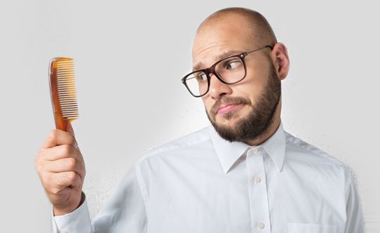 people affected by male pattern baldness