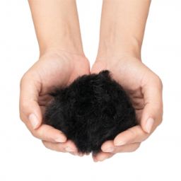 symptoms of alopecia