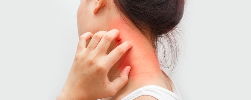 symptoms of dermatitis