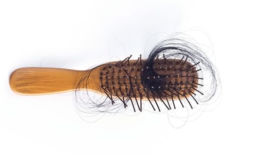 symptoms of male pattern baldness