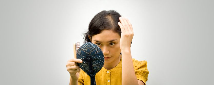 what is female pattern baldness
