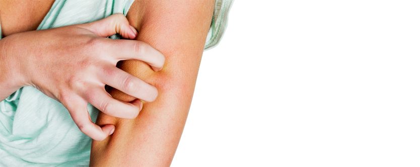 what is urticaria