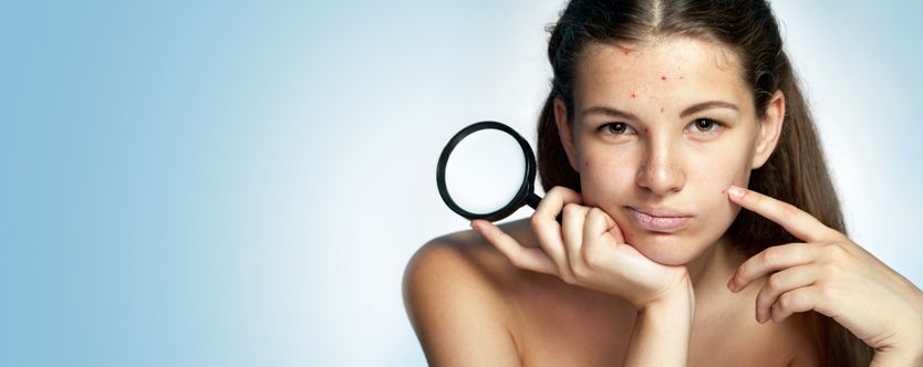 curing skin problems with homeopathy
