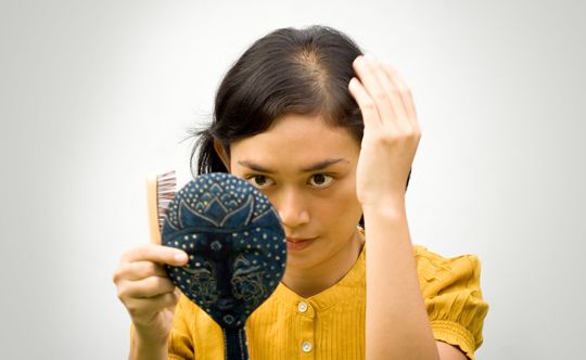 female-pattern-baldness-scalia-gallery-fullwidth