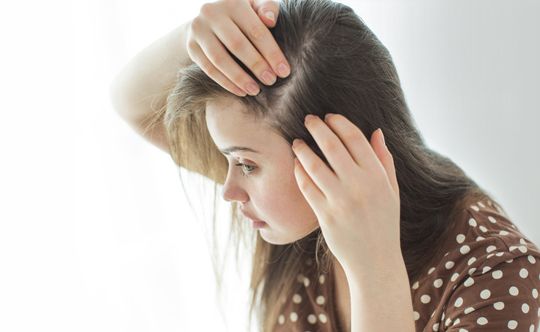 hair-loss-after-hair-colouring-scalia-gallery-fullwidth