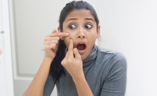 homeopathic-remedies-for-acne-pimples