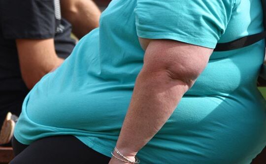 11obesity-gastric-disorders