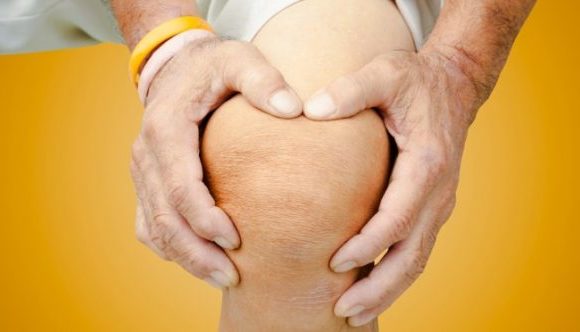 JointPain in Obesity