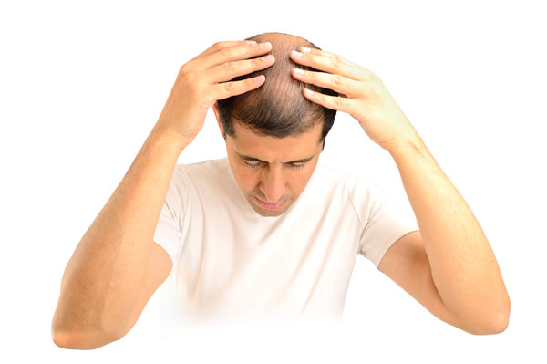 Homeopathy Plan for Telogen Effluvium