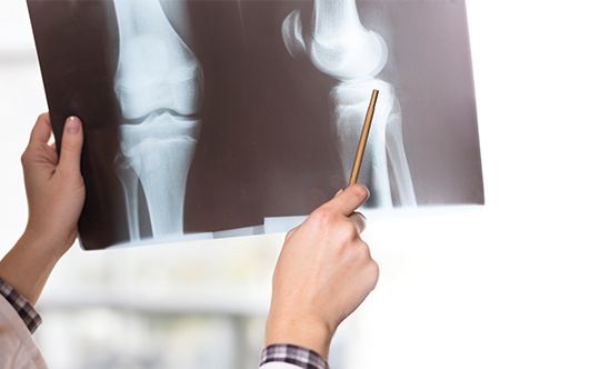 Featured-Food-that-is-harmful-for-your-bones-for-website