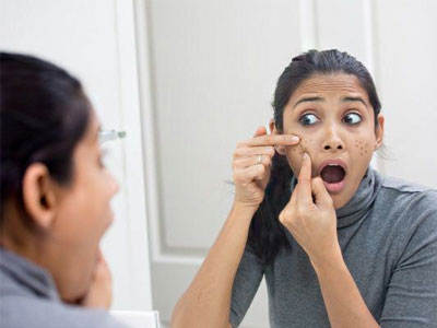 Homeopathy Plan for Skin Issues