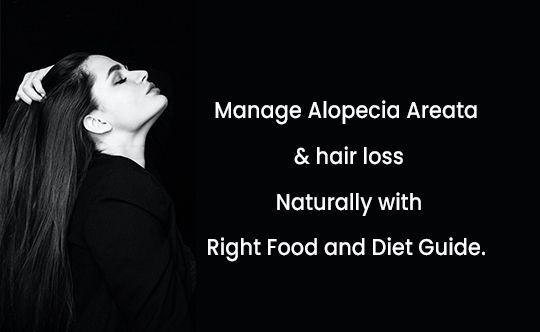 manage alopecia areta _ hair loss naturally with right food and diet guide