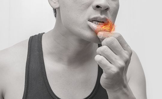 15-natural-ways-to-manage-mouth-ulcers-with-diet-plan-banner-540-X-332