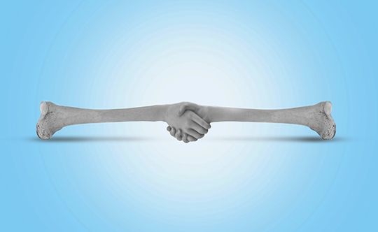 boost-your-bone-health-with-these-easy-diet-tips-this-world-osteoporosis-day-banner-540-X-332