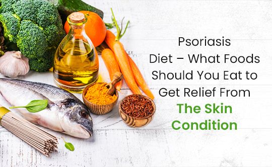 psoriasis diet-what-foods-should-you-eat-to-get-relief-from-the-skin-condition-banner-540-X-332