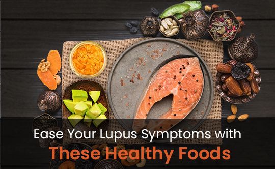 lupus diet